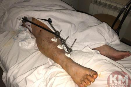 Павел Грудинин приехал в больницу к Ивану Егорову, получившему травму на выборах в Москве